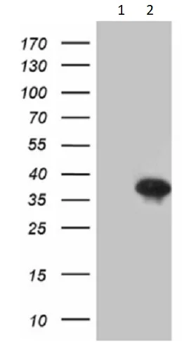 Western blot - Anti-Dlx1 antibody [OTI1E6] (AB236381)
