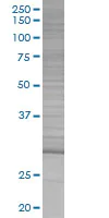 SDS-PAGE - Dlx1 overexpression 293T lysate (whole cell) (AB94117)
