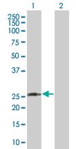 Dlx1 overexpression 293T lysate (whole cell)