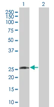 Western blot - Dlx1 overexpression 293T lysate (whole cell) (AB94117)