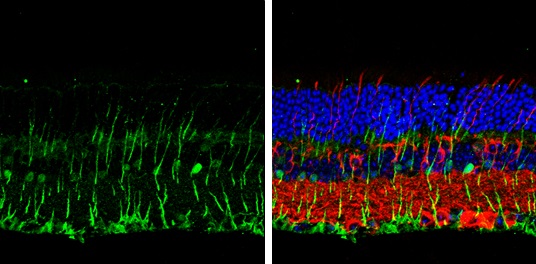 Immunohistochemistry (Formalin/PFA-fixed paraffin-embedded sections) - Anti-Dlx2 antibody (AB272902), expandable thumbnail
