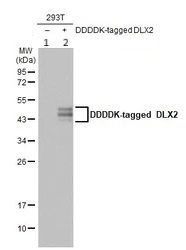 Western blot - Anti-Dlx2 antibody (AB272902)