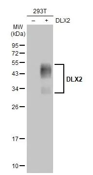 Western blot - Anti-DLX2 antibody [HL1942] (AB308209)