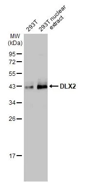 Western blot - Anti-DLX2 antibody [HL1942] (AB308209)