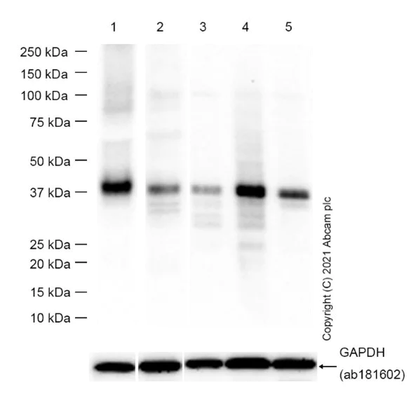 Western blot - Anti-DLX3 antibody [EPR8762(2)] - BSA and Azide free (AB250049)