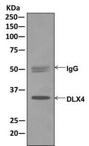 Immunoprecipitation - Anti-Dlx4/BP1 antibody [EPR9263] - BSA and Azide free (AB249869), expandable thumbnail