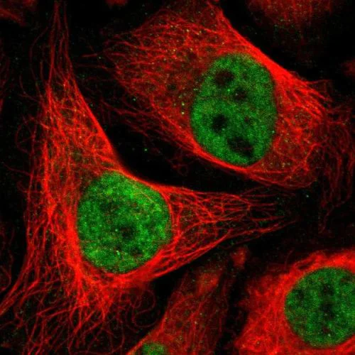 Immunocytochemistry/ Immunofluorescence - Anti-Dlx5 antibody (AB244281)