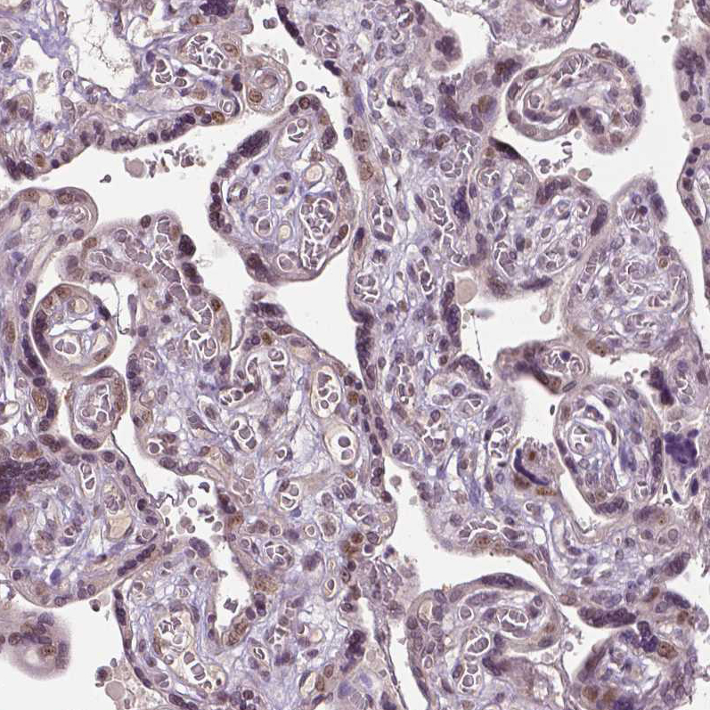 Immunohistochemistry (Formalin/PFA-fixed paraffin-embedded sections) - Anti-Dlx5 antibody (AB244281)