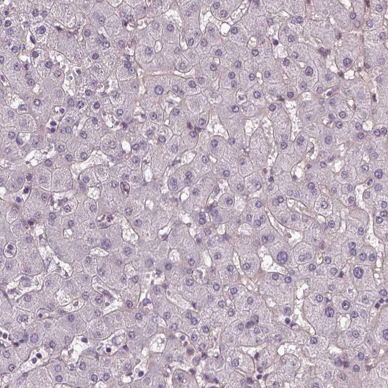 Immunohistochemistry (Formalin/PFA-fixed paraffin-embedded sections) - Anti-Dlx5 antibody (AB244281)