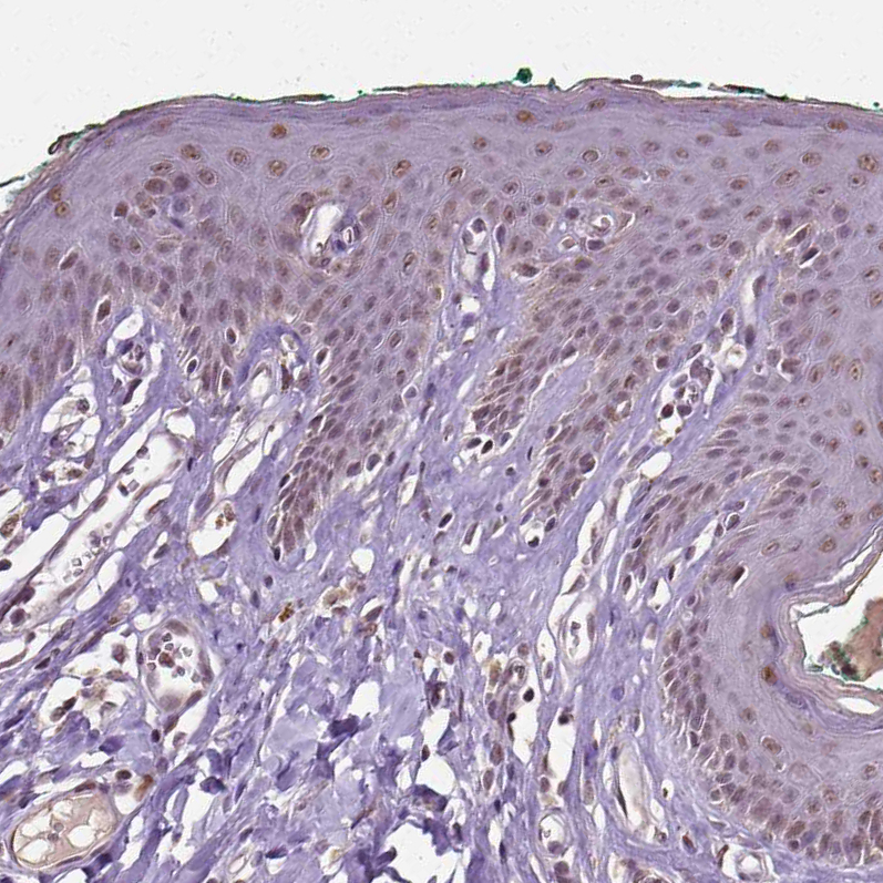Immunohistochemistry (Formalin/PFA-fixed paraffin-embedded sections) - Anti-Dlx5 antibody (AB244281)