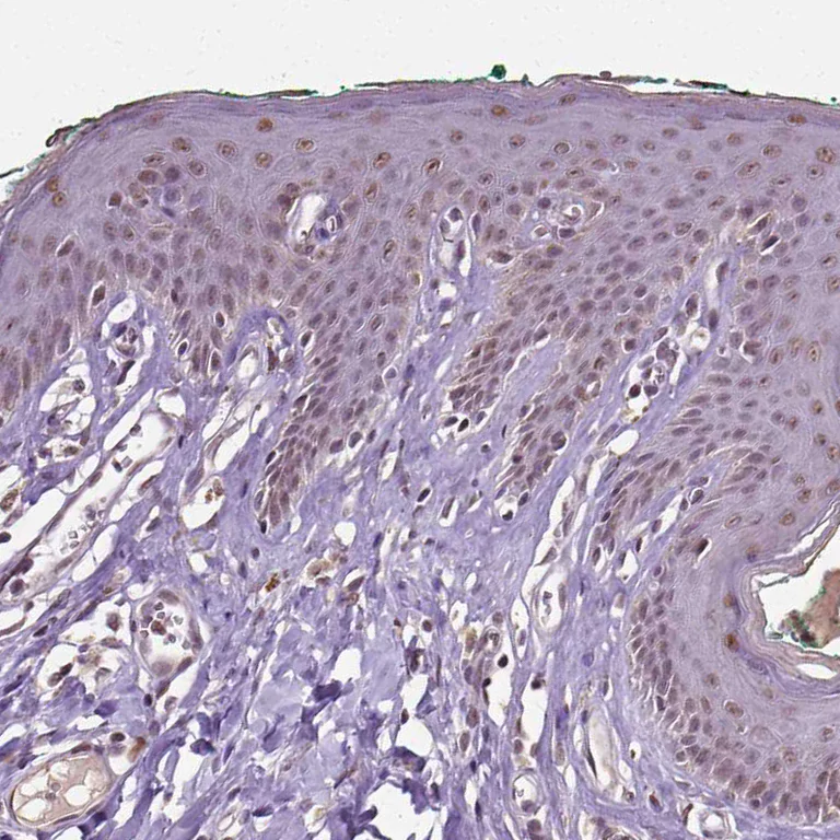 Immunohistochemistry (Formalin/PFA-fixed paraffin-embedded sections) - Anti-Dlx5 antibody (AB244281)