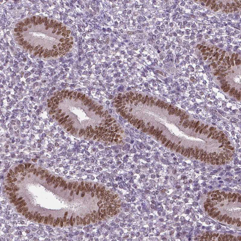 Immunohistochemistry (Formalin/PFA-fixed paraffin-embedded sections) - Anti-Dlx5 antibody (AB244281)
