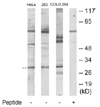 Western blot - Anti-Dlx5 antibody (AB64827)