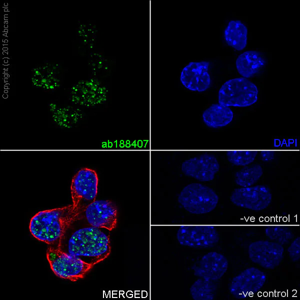 Immunocytochemistry/ Immunofluorescence - Anti-DMAP1 antibody [EPR18179] (AB188407)