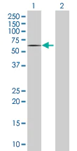 Western blot - DMAP1 overexpression 293T lysate (whole cell) (AB94262)