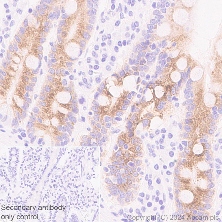 Immunohistochemistry (Formalin/PFA-fixed paraffin-embedded sections) - Anti-DMBT1 antibody [EPR25722-10] (AB316185)