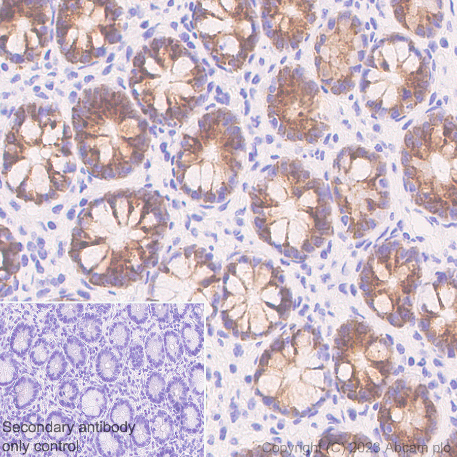 Immunohistochemistry (Formalin/PFA-fixed paraffin-embedded sections) - Anti-DMBT1 antibody [EPR25722-10] - BSA and Azide free (ab316186), expandable thumbnail