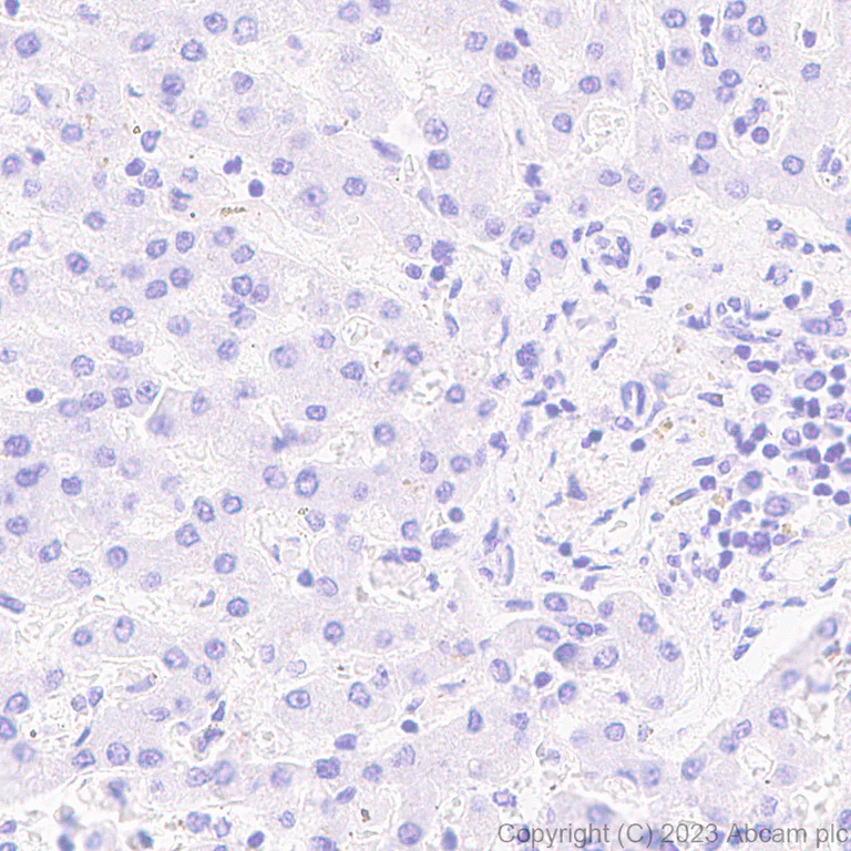 Immunohistochemistry (Formalin/PFA-fixed paraffin-embedded sections) - Anti-DMBT1 antibody [EPR25722-10] - BSA and Azide free (AB316186)