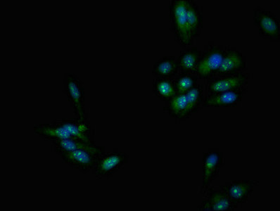 Immunocytochemistry/ Immunofluorescence - Anti-DMC1 antibody (AB237733), expandable thumbnail
