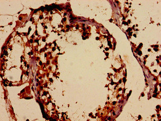 Immunohistochemistry (Formalin/PFA-fixed paraffin-embedded sections) - Anti-DMC1 antibody (AB237733), expandable thumbnail