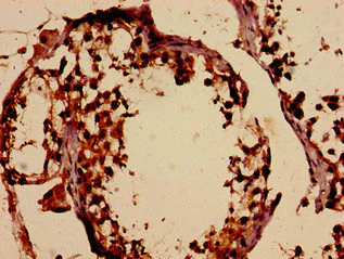 Immunohistochemistry (Formalin/PFA-fixed paraffin-embedded sections) - Anti-DMC1 antibody (AB237733)