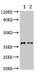Western blot - Anti-DMC1 antibody (AB237733), expandable thumbnail