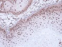 Immunohistochemistry (Formalin/PFA-fixed paraffin-embedded sections) - Anti-DMC1 antibody (AB96613)