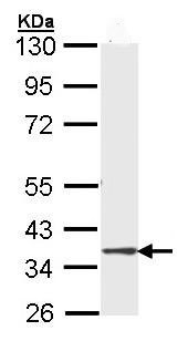 Western blot - Anti-DMC1 antibody (AB96613), expandable thumbnail