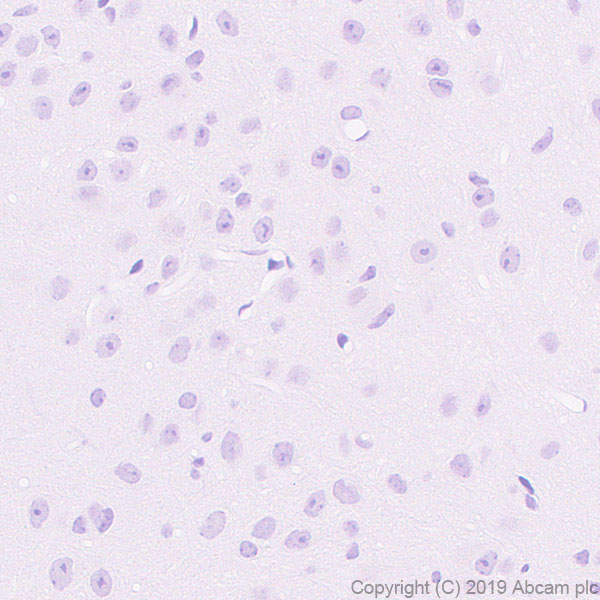 Immunohistochemistry (Formalin/PFA-fixed paraffin-embedded sections) - Anti-DMC1 antibody [EPR23207-130] - BSA and Azide free (AB269869), expandable thumbnail