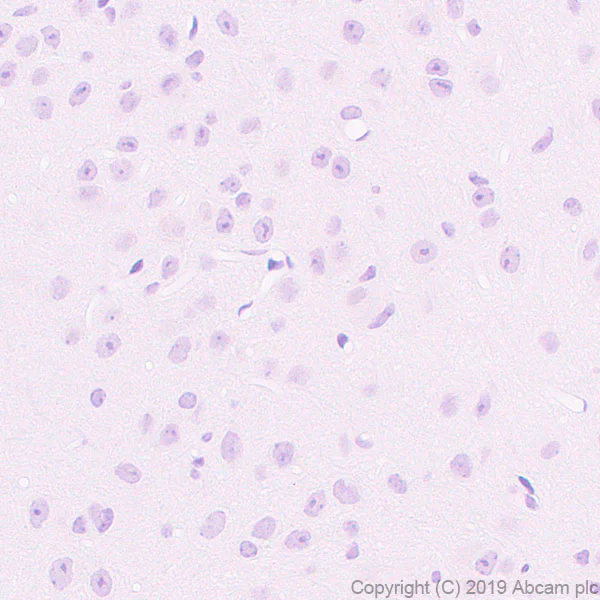 Immunohistochemistry (Formalin/PFA-fixed paraffin-embedded sections) - Anti-DMC1 antibody [EPR23207-130] - BSA and Azide free (AB269869)