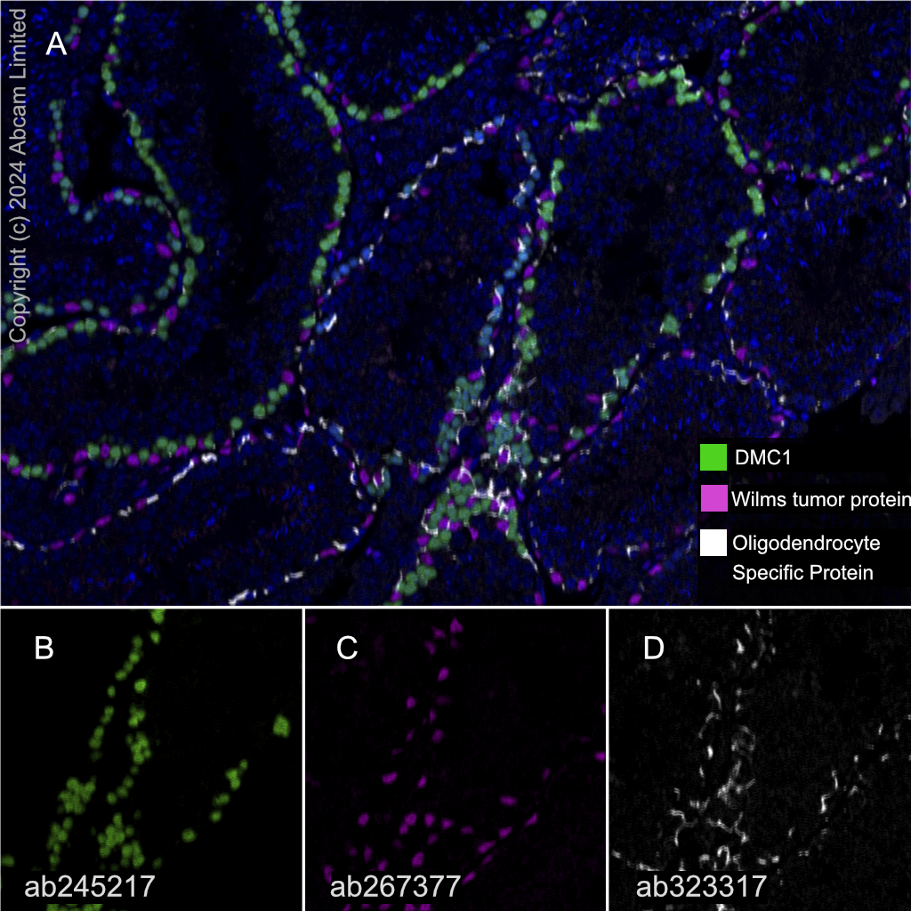 Multiplex immunohistochemistry - Anti-DMC1 antibody [EPR23207-130] - BSA and Azide free (AB269869)