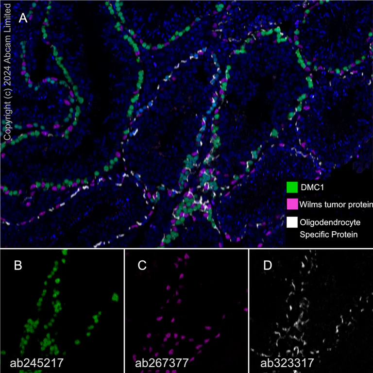 Multiplex immunohistochemistry - Anti-DMC1 antibody [EPR23207-130] - BSA and Azide free (AB269869)
