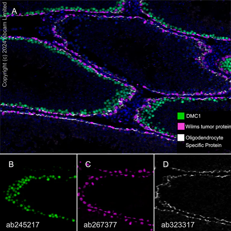 Multiplex immunohistochemistry - Anti-DMC1 antibody [EPR23207-130] - BSA and Azide free (AB269869)