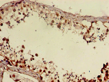 Immunohistochemistry (Formalin/PFA-fixed paraffin-embedded sections) - Anti-DMRT1 antibody (AB222895)