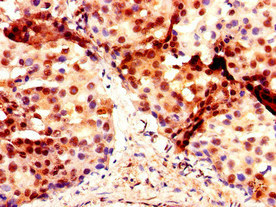 Immunohistochemistry (Formalin/PFA-fixed paraffin-embedded sections) - Anti-DMRT1 antibody (AB222895)