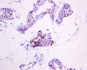 Immunohistochemistry (Formalin/PFA-fixed paraffin-embedded sections) - Anti-DMRT1 antibody [EPR6936-209] - BSA and Azide free (AB249377)