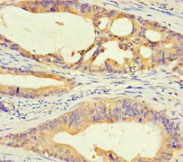 Immunohistochemistry (Formalin/PFA-fixed paraffin-embedded sections) - Anti-DMRTA1 antibody (AB238679)