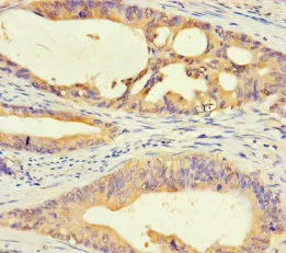 Immunohistochemistry (Formalin/PFA-fixed paraffin-embedded sections) - Anti-DMRTA1 antibody (AB238679)