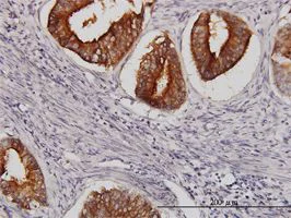 Immunohistochemistry (Formalin/PFA-fixed paraffin-embedded sections) - Anti-DMT1 antibody [4C6] (AB55735)