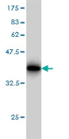 Western blot - Anti-DMT1 antibody [4C6] (AB55735)