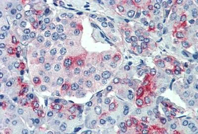 Immunohistochemistry (Formalin/PFA-fixed paraffin-embedded sections) - Anti-DMT1 antibody (AB140977)