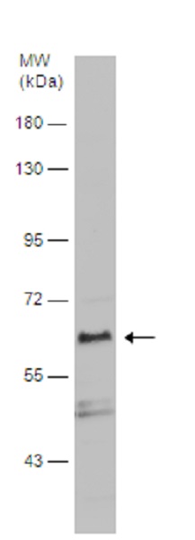 Western blot - Anti-DMT1 antibody (AB262715)