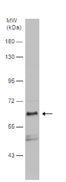 Western blot - Anti-DMT1 antibody (AB262715)