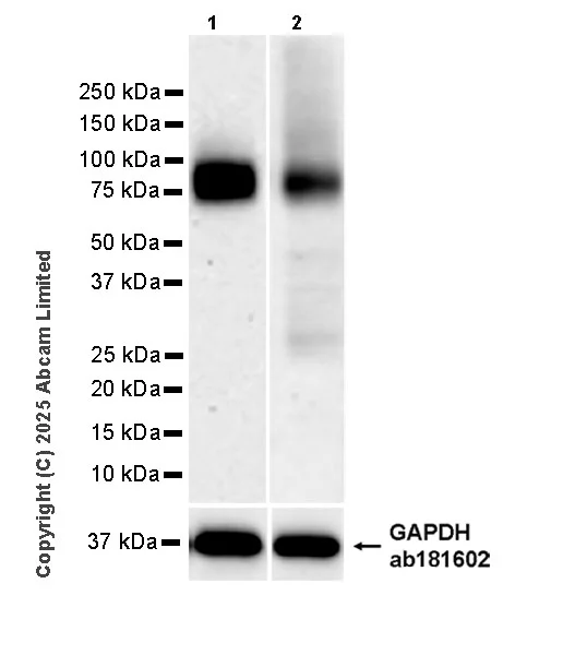 Western blot - Anti-DMT1 antibody [EPR29592-29] - BSA and Azide free (AB324359)