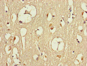 Immunohistochemistry (Formalin/PFA-fixed paraffin-embedded sections) - Anti-DMXL2 antibody (AB234771)