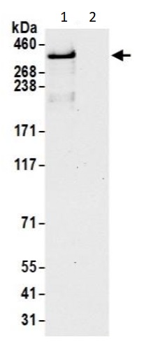Immunoprecipitation - Anti-DMXL2 antibody (AB240690), expandable thumbnail