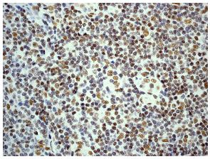 Immunohistochemistry (Formalin/PFA-fixed paraffin-embedded sections) - Anti-DN-7 antibody [EPR5266] - BSA and Azide free (AB248418)