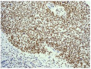 Immunohistochemistry (Formalin/PFA-fixed paraffin-embedded sections) - Anti-DN-7 antibody [EPR5266] - BSA and Azide free (AB248418)