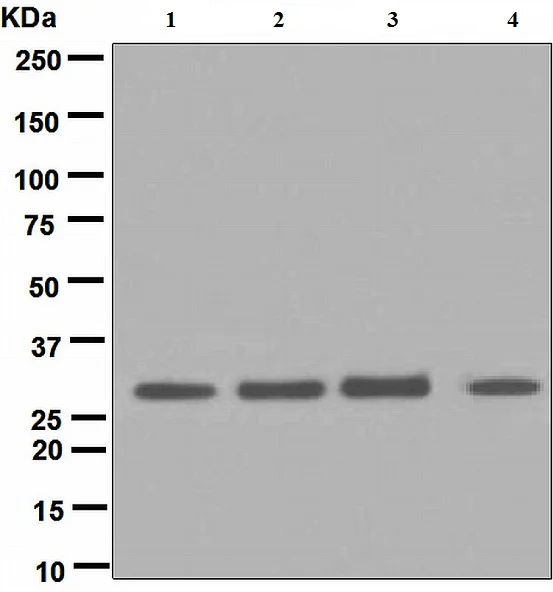 Western blot - Anti-DN-7 antibody [EPR5266] - BSA and Azide free (AB248418)