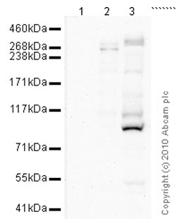 Western blot - DNA Damage Kinases Panel (ATM, ATM pS1981, ATR, ATR pS428, DNA-PKcs, DNA-PKcs pS2056) (AB103970), expandable thumbnail